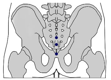 DT.17